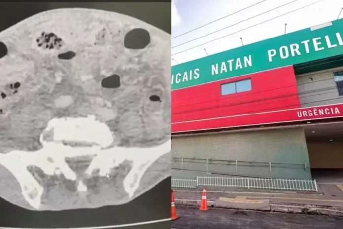 edicao-imagens-g1-9-1-1-rif7dq93oab900p4c78v4gj26wxpvggb3rcp54n0ow